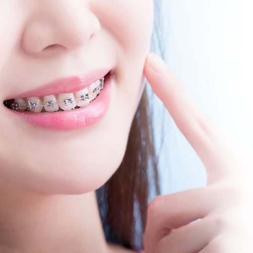 ทำฟัน ขอนแก่น ราคา