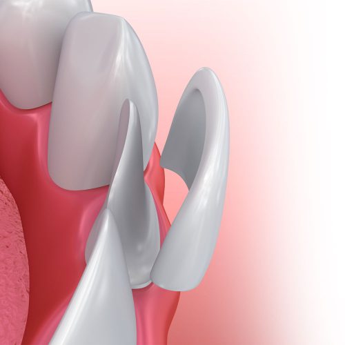 ทำฟัน ขอนแก่น ราคา