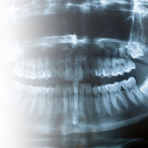 ทำฟัน ขอนแก่น ราคา