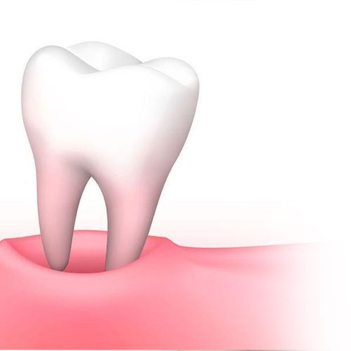 ทำฟัน ขอนแก่น ราคา