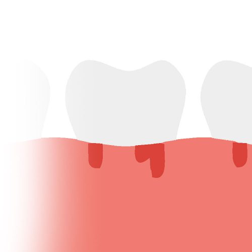 ทำฟัน ขอนแก่น ราคา