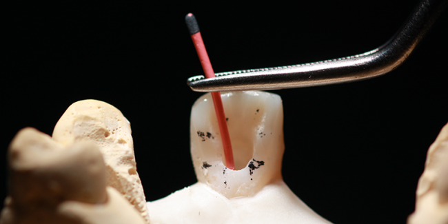 ทำฟัน ขอนแก่น ราคา